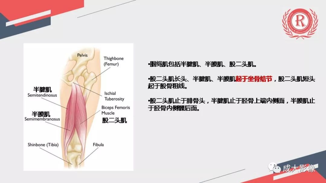 影像PPT - 【PPT】坐骨股骨撞击综合征MR影像诊断-8 影像PPT - 【PPT】坐骨股骨撞击综合征MR影像诊断-8