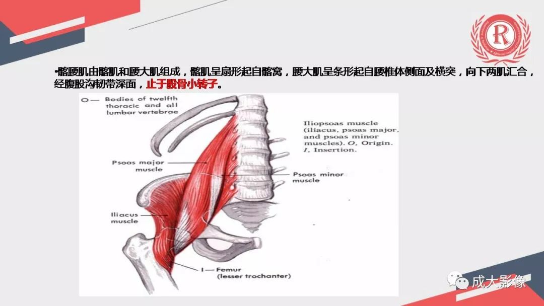 影像PPT - 【PPT】坐骨股骨撞击综合征MR影像诊断-9 影像PPT - 【PPT】坐骨股骨撞击综合征MR影像诊断-9