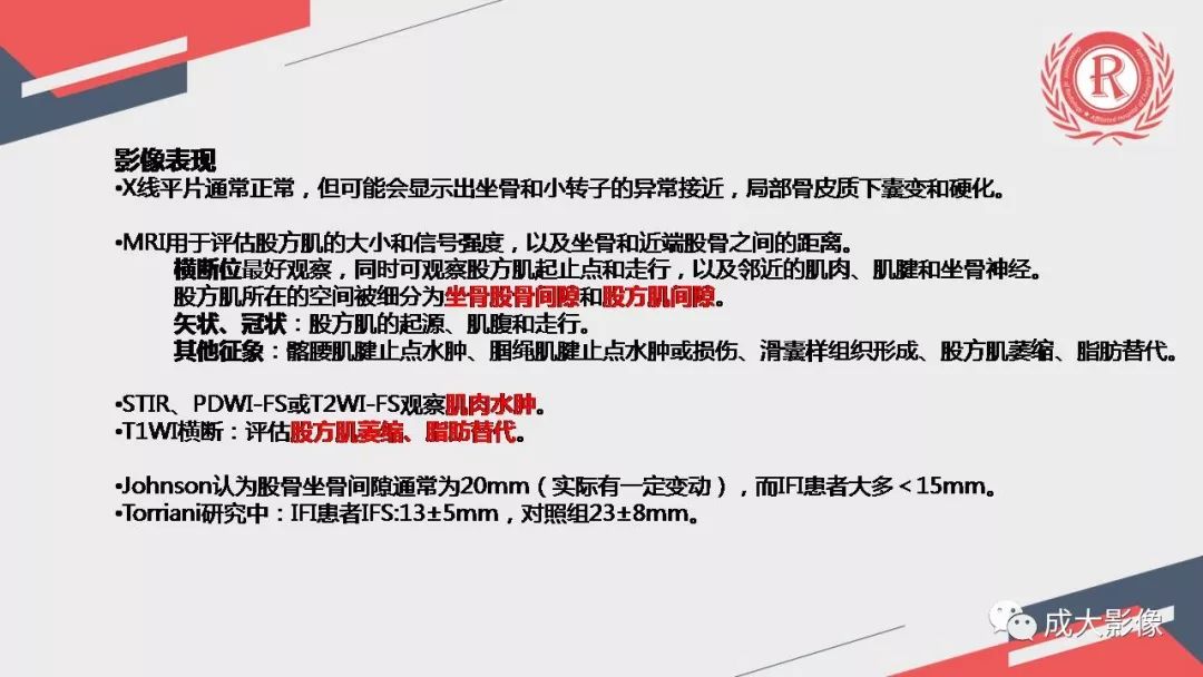 影像PPT - 【PPT】坐骨股骨撞击综合征MR影像诊断-16 影像PPT - 【PPT】坐骨股骨撞击综合征MR影像诊断-16