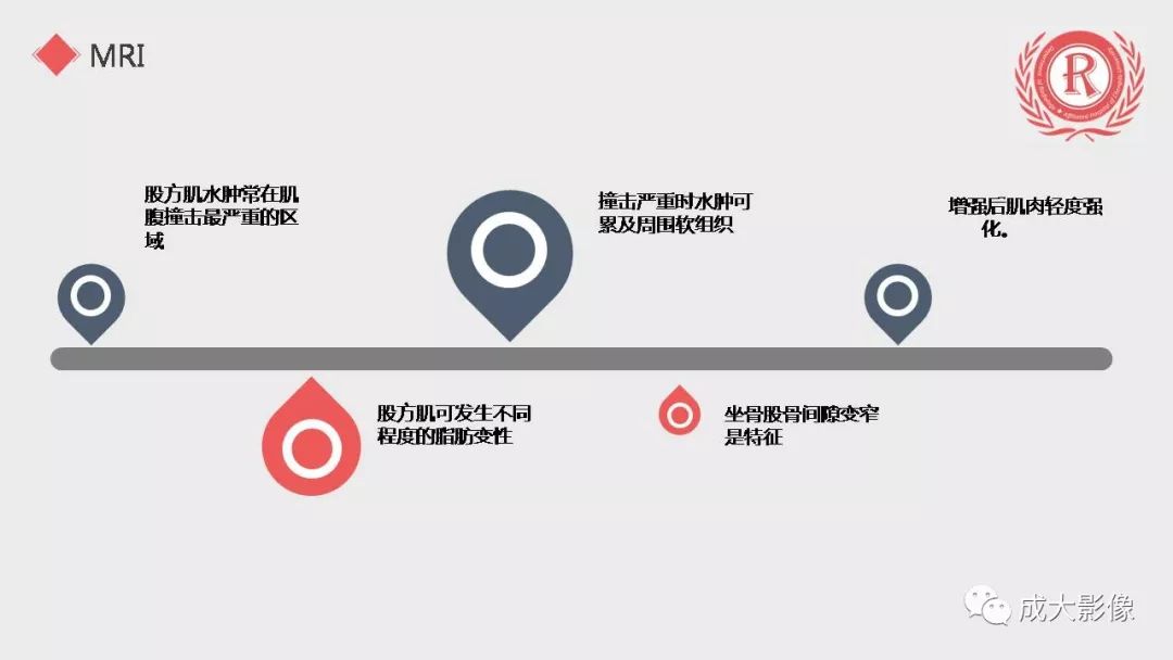 影像PPT - 【PPT】坐骨股骨撞击综合征MR影像诊断-21 影像PPT - 【PPT】坐骨股骨撞击综合征MR影像诊断-21