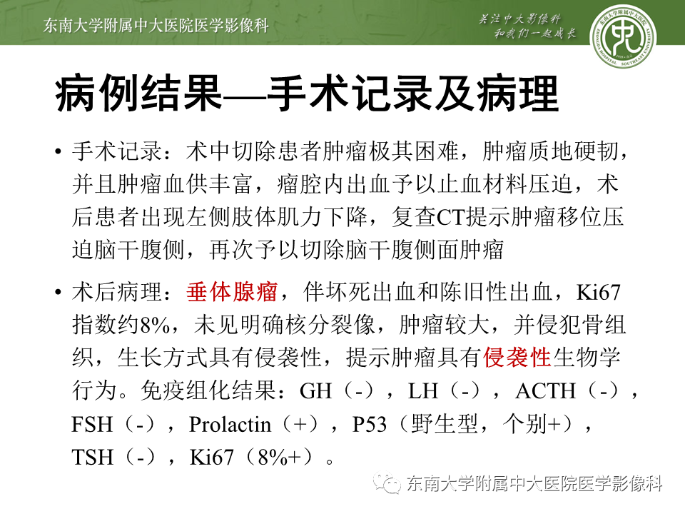 影像PPT - 【PPT】斜坡区脊索瘤的故事-4
