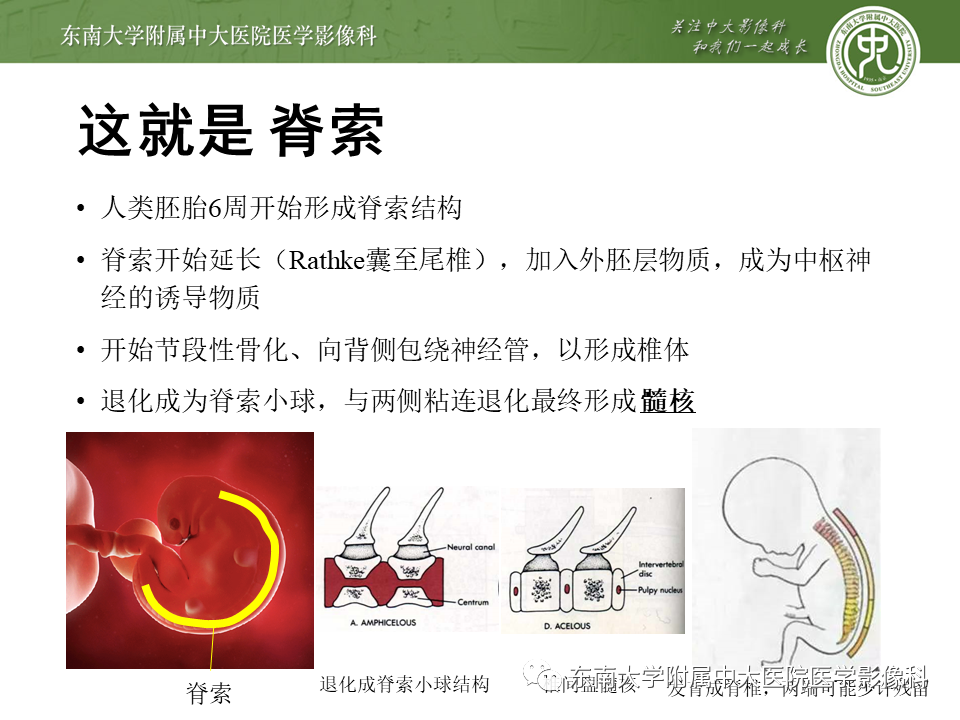 影像PPT - 【PPT】斜坡区脊索瘤的故事-8