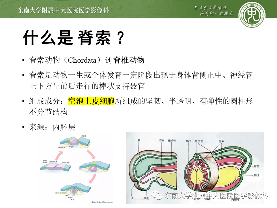 影像PPT - 【PPT】斜坡区脊索瘤的故事-7