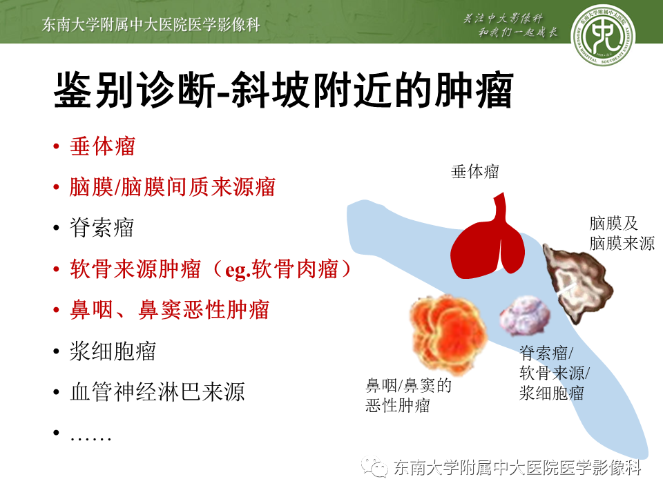 影像PPT - 【PPT】斜坡区脊索瘤的故事-16