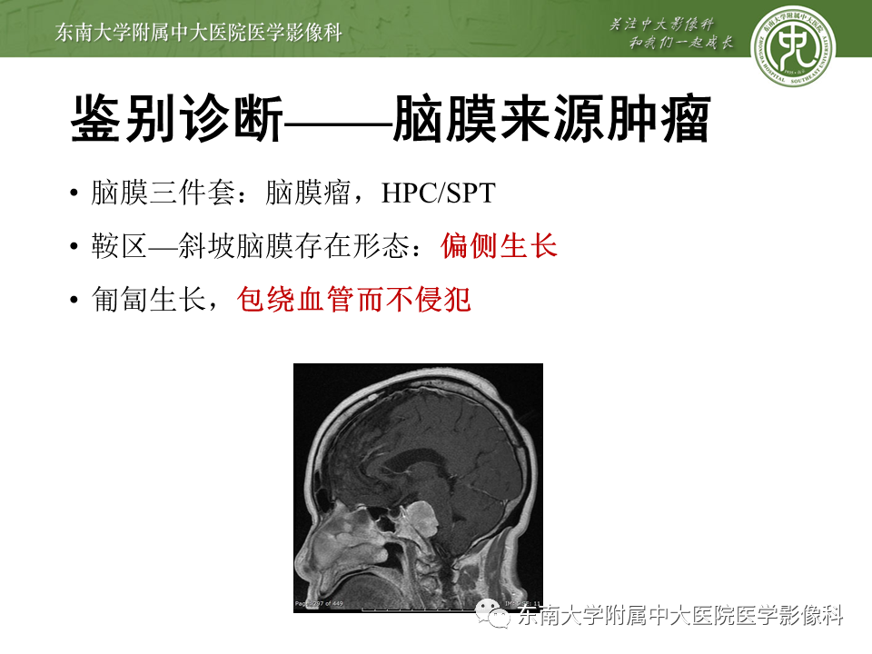 影像PPT - 【PPT】斜坡区脊索瘤的故事-19