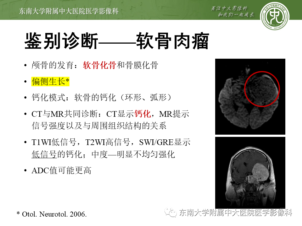 影像PPT - 【PPT】斜坡区脊索瘤的故事-21
