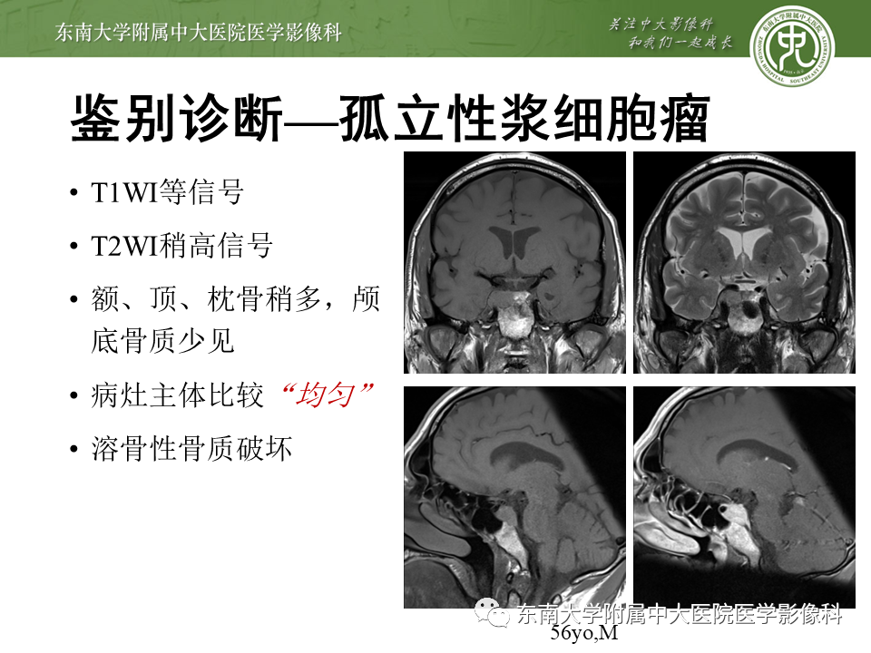 影像PPT - 【PPT】斜坡区脊索瘤的故事-23