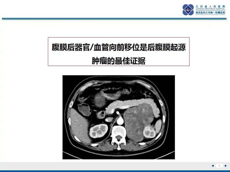 影像PPT - 【PPT】肾上腺区占位——胃间质瘤-10