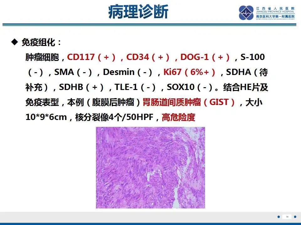 影像PPT - 【PPT】肾上腺区占位——胃间质瘤-15