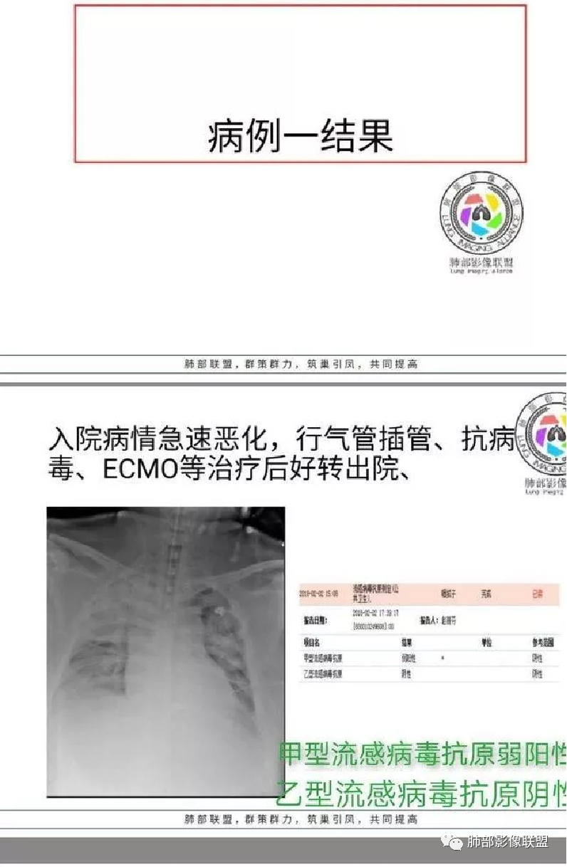影像PPT - 【病例】透过影像识病毒—病毒性肺炎4例影像-37