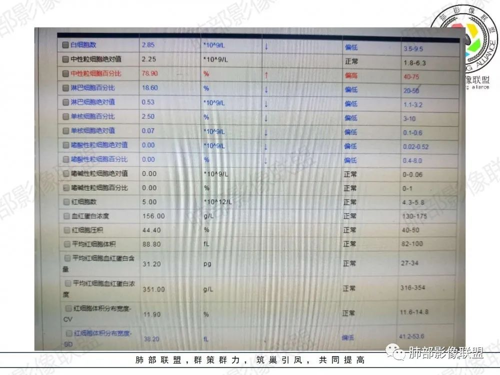 影像PPT - 【病例】透过影像识病毒—病毒性肺炎4例影像-43