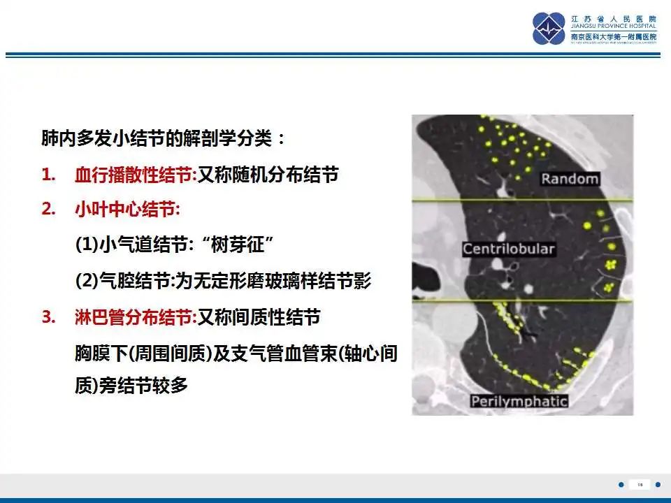 影像PPT - 【PPT】电焊工尘肺/铁尘肺-16