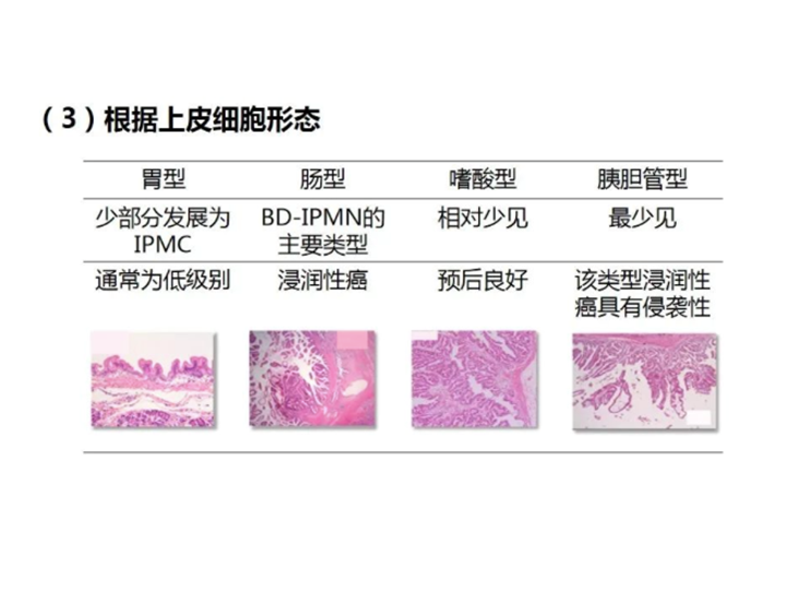 影像PPT - 【病例】胰腺导管内乳头状粘液瘤 VS 慢性胰腺炎-35