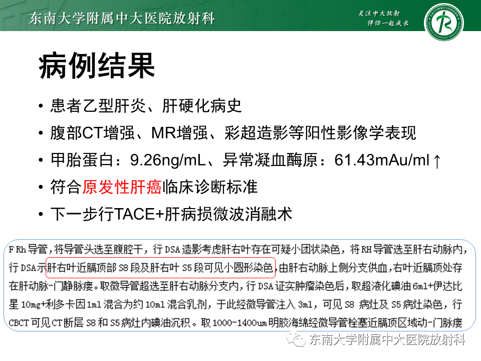 影像PPT - 【PPT】肝硬化结节和早期肝癌的MRI诊断和鉴别-5