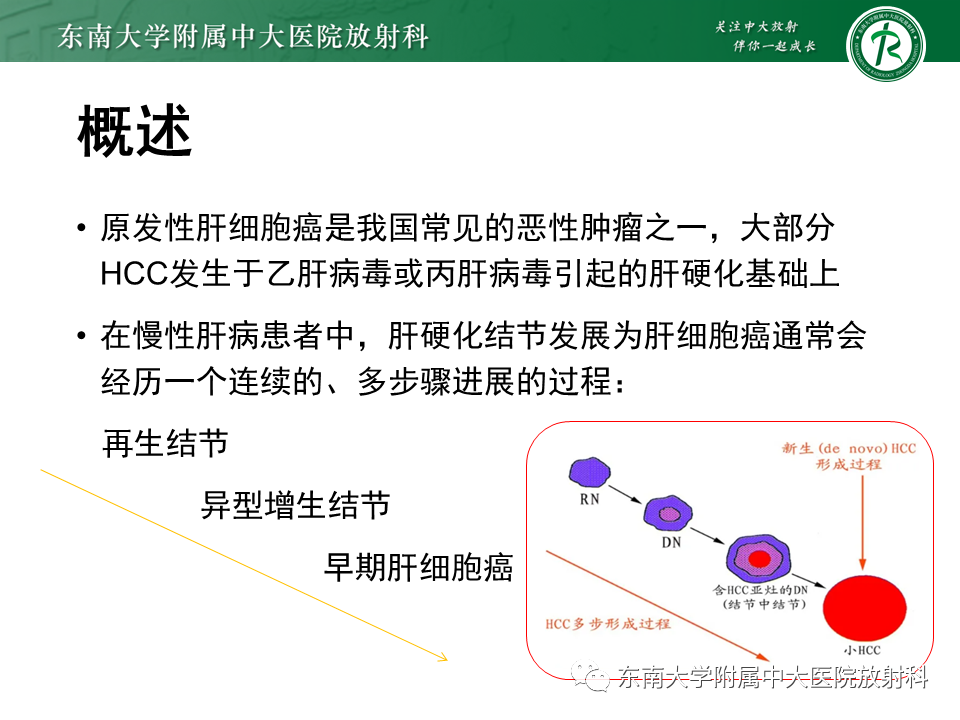 影像PPT - 【PPT】肝硬化结节和早期肝癌的MRI诊断和鉴别-7