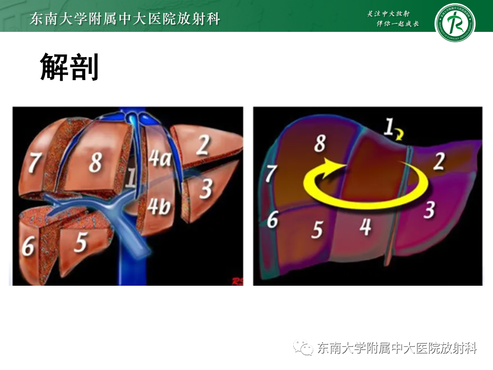 影像PPT - 【PPT】肝硬化结节和早期肝癌的MRI诊断和鉴别-10