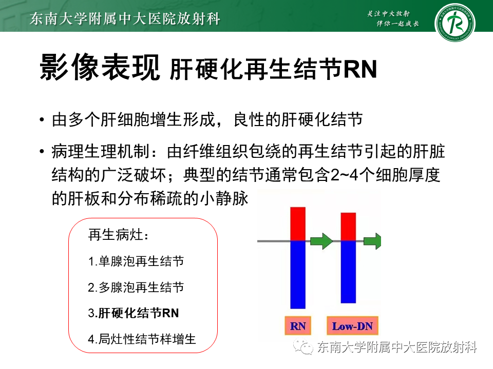 影像PPT - 【PPT】肝硬化结节和早期肝癌的MRI诊断和鉴别-11