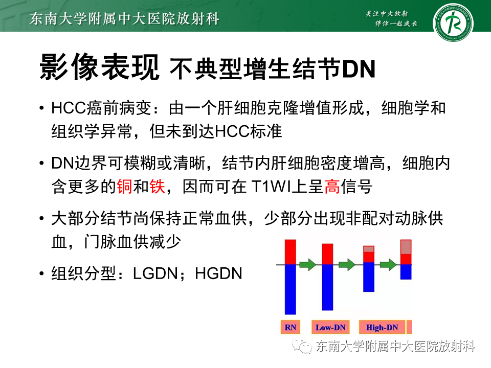 影像PPT - 【PPT】肝硬化结节和早期肝癌的MRI诊断和鉴别-16