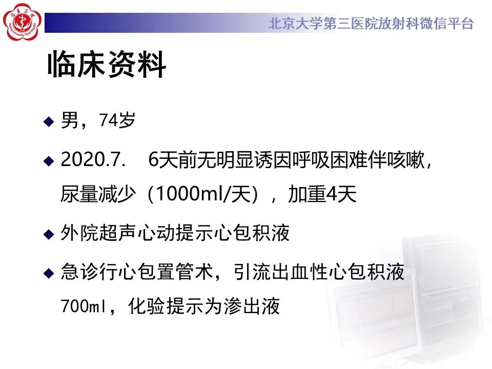 影像PPT - 【PPT】主动脉周围淋巴瘤-2