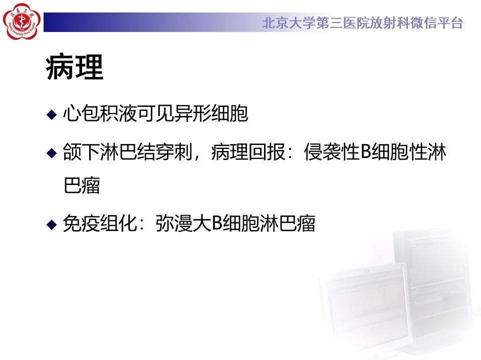 影像PPT - 【PPT】主动脉周围淋巴瘤-12