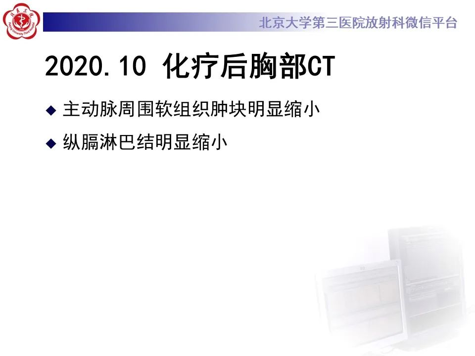 影像PPT - 【PPT】主动脉周围淋巴瘤-14