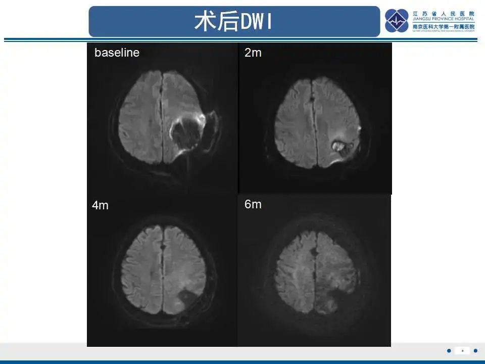 影像PPT - 【PPT】胶质瘤治疗后假性进展-7