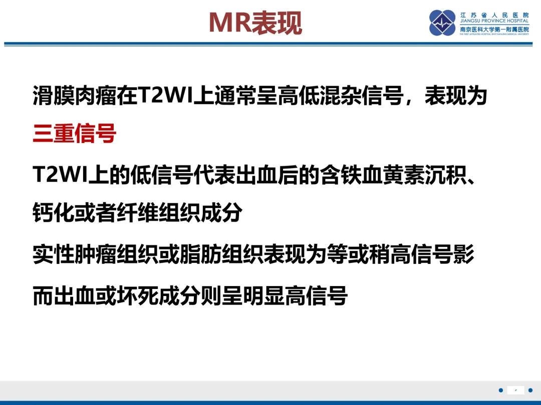 影像PPT - 【PPT】滑膜肉瘤-27