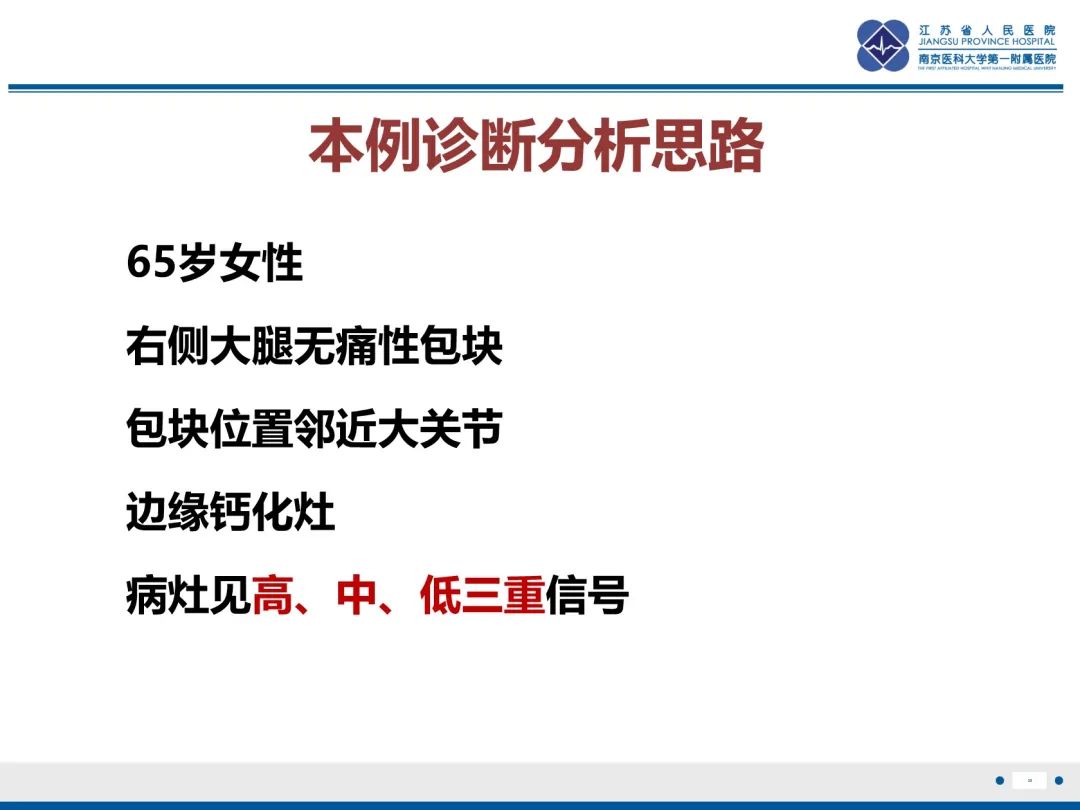 影像PPT - 【PPT】滑膜肉瘤-39