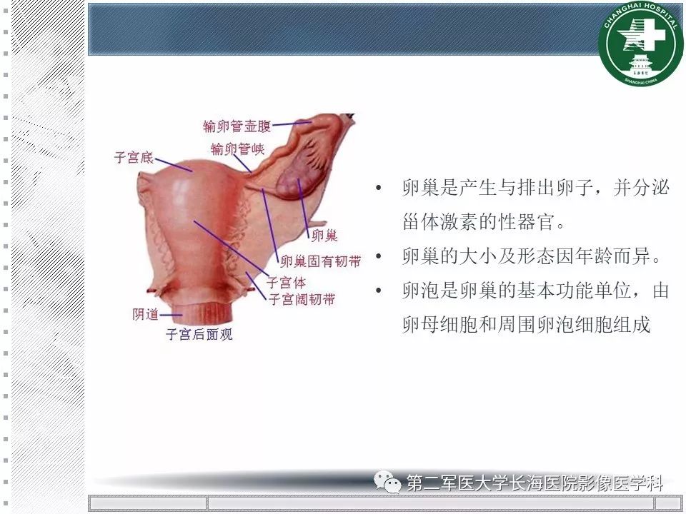 影像PPT - 【PPT】卵巢及其囊性病变-3