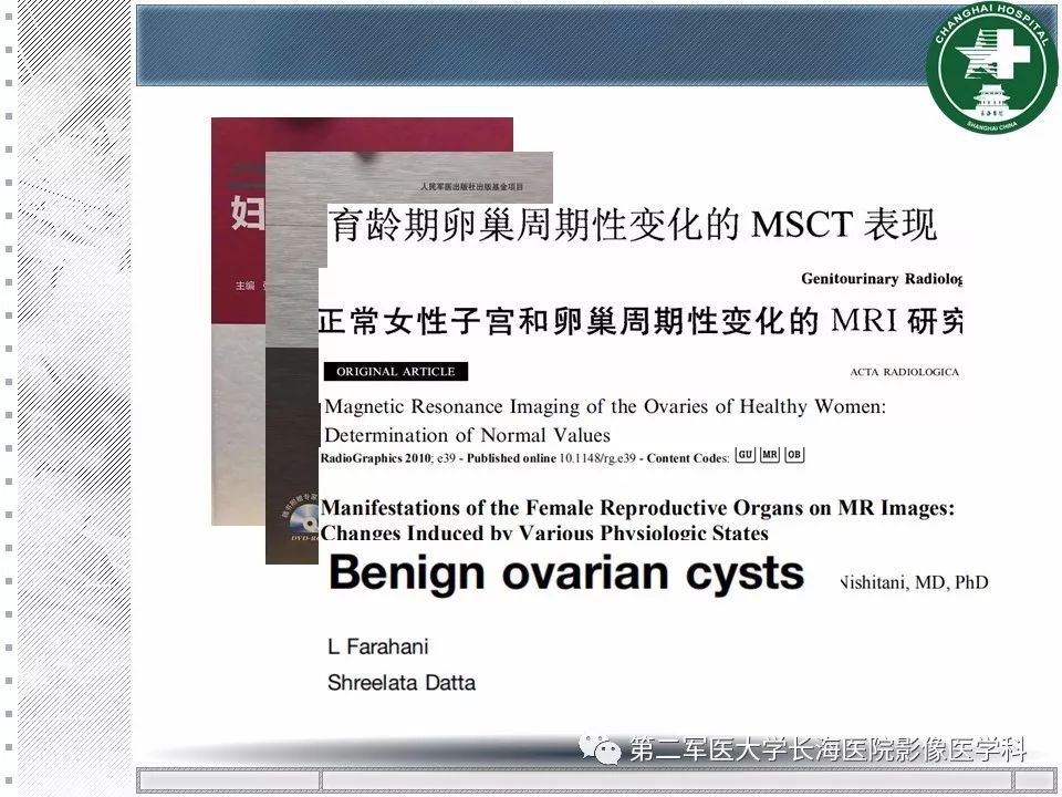 影像PPT - 【PPT】卵巢及其囊性病变-62