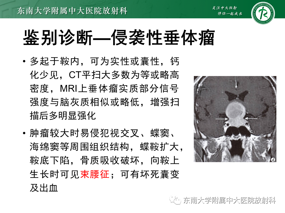 影像PPT - 【PPT】脊索瘤的影像-24