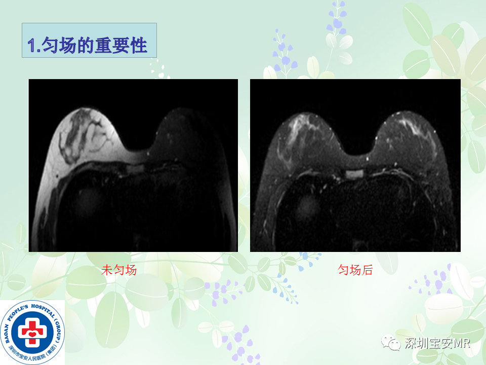 影像PPT - 【PPT】乳腺磁共振扫描-9