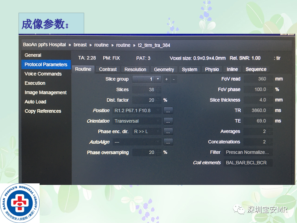 影像PPT - 【PPT】乳腺磁共振扫描-7