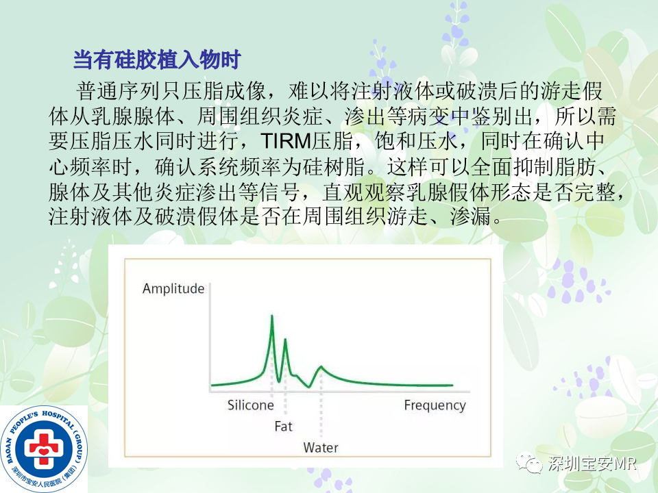 影像PPT - 【PPT】乳腺磁共振扫描-11