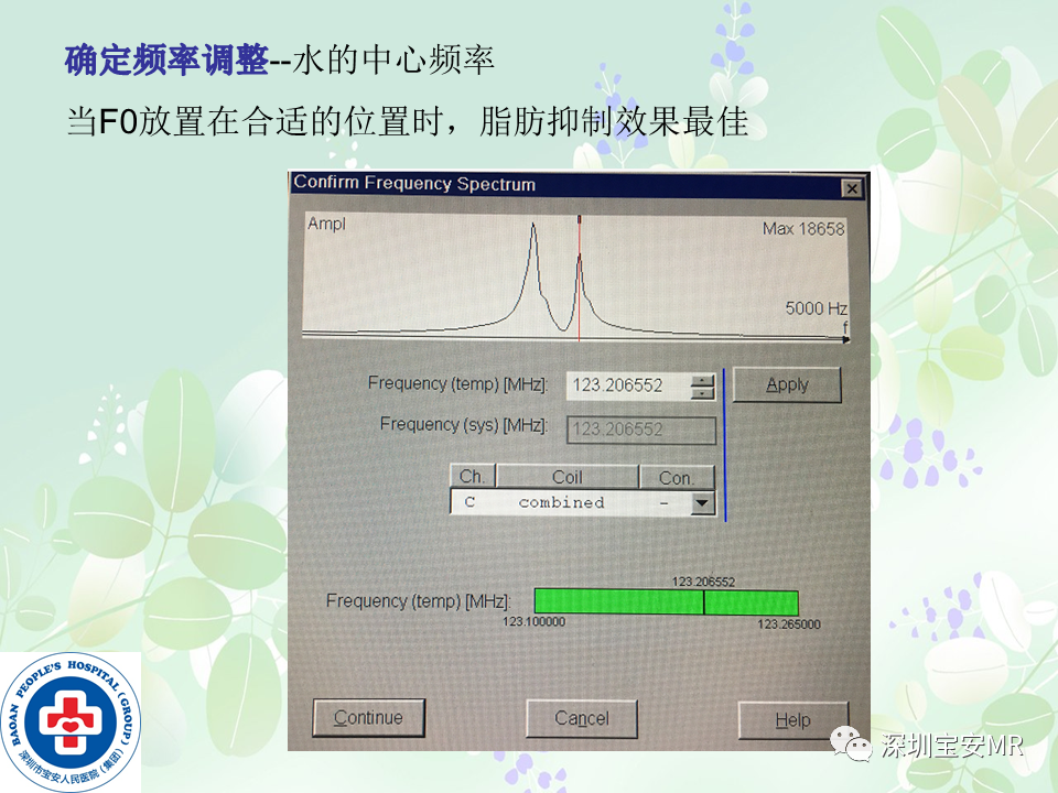 影像PPT - 【PPT】乳腺磁共振扫描-10