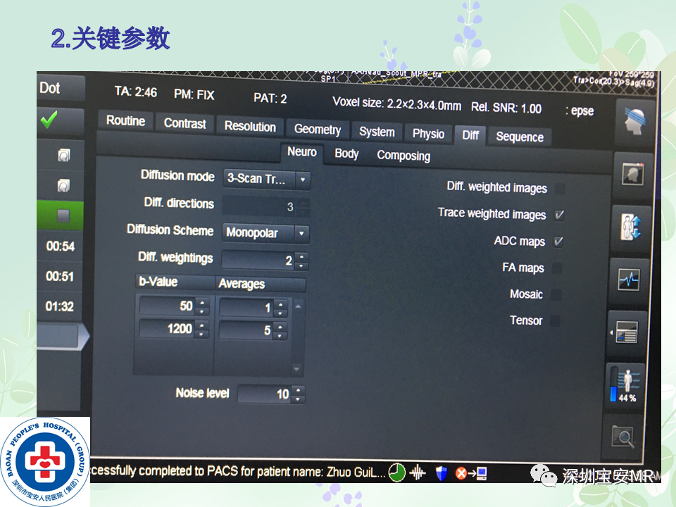 影像PPT - 【PPT】乳腺磁共振扫描-14