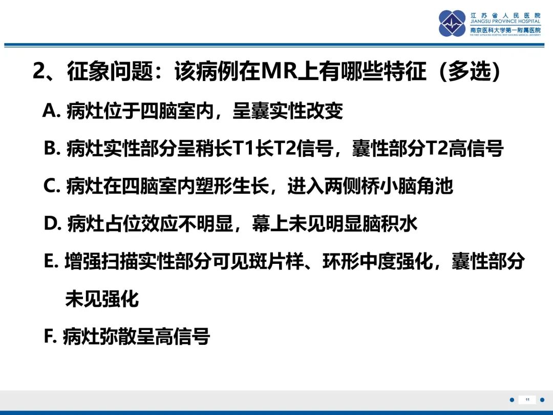 影像PPT - 【PPT】菊形团形成型胶质神经元肿瘤-12