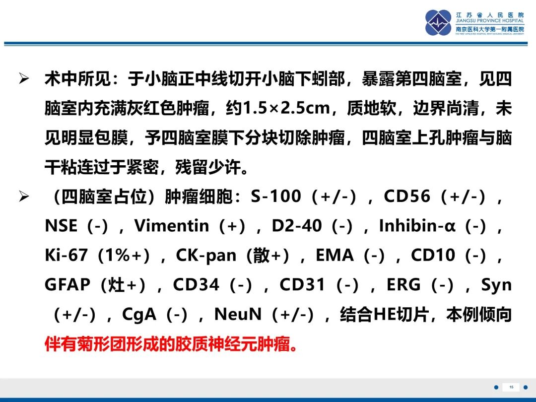 影像PPT - 【PPT】菊形团形成型胶质神经元肿瘤-16