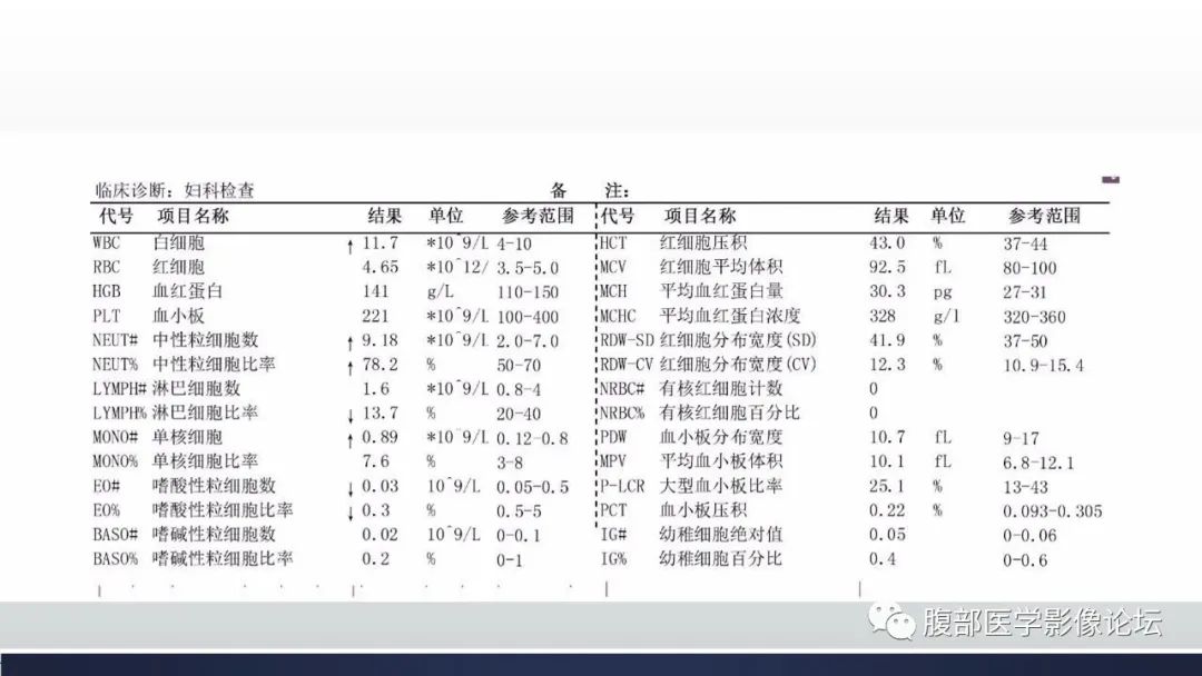 影像PPT - 【病例】肝脏上皮样血管内皮瘤1例CT影像-3