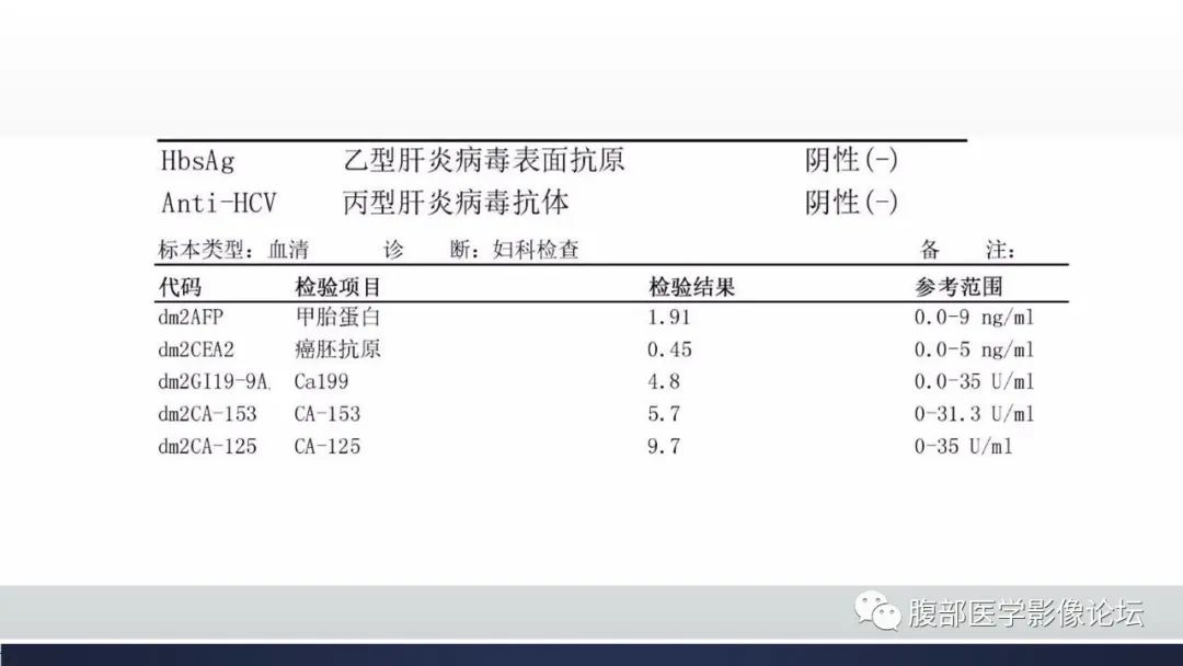 影像PPT - 【病例】肝脏上皮样血管内皮瘤1例CT影像-4