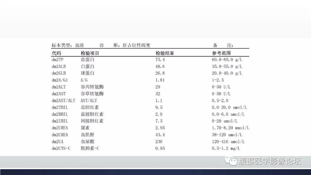 影像PPT - 【病例】肝脏上皮样血管内皮瘤1例CT影像-5