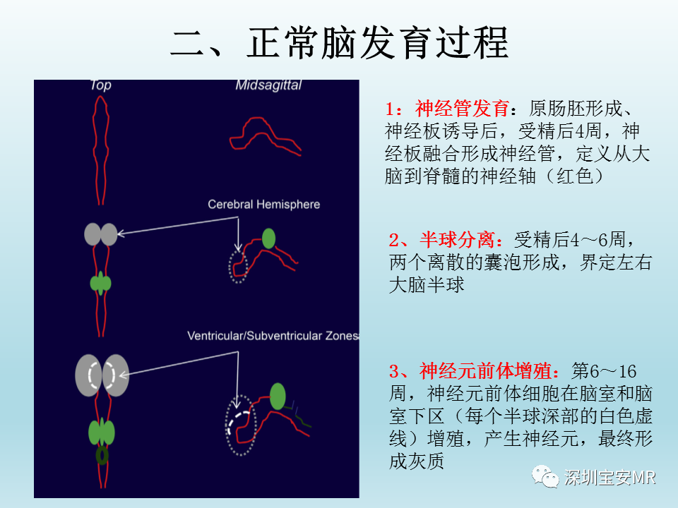 影像PPT - 【PPT】幕上脑畸形MRI表现-4