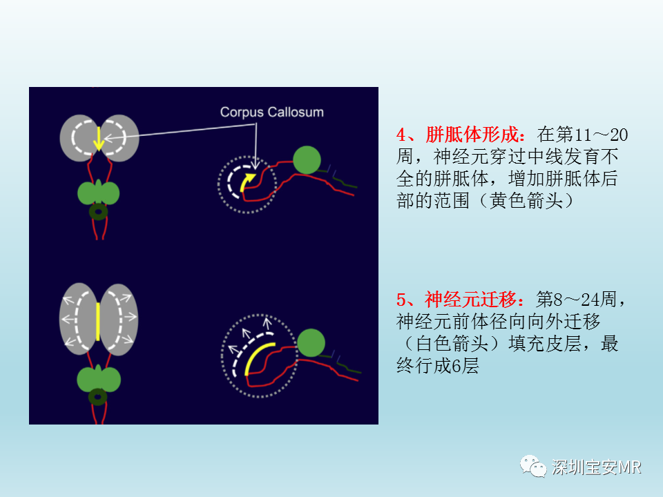 影像PPT - 【PPT】幕上脑畸形MRI表现-5