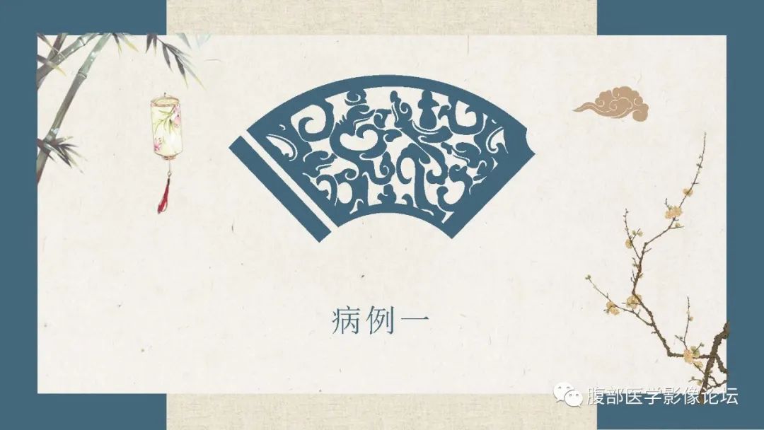 影像PPT - 【病例】卵巢纤维瘤 VS 子宫阔韧带肌瘤-2