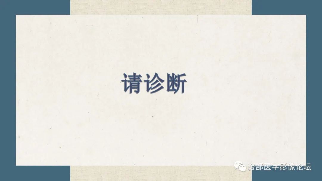 影像PPT - 【病例】卵巢纤维瘤 VS 子宫阔韧带肌瘤-11