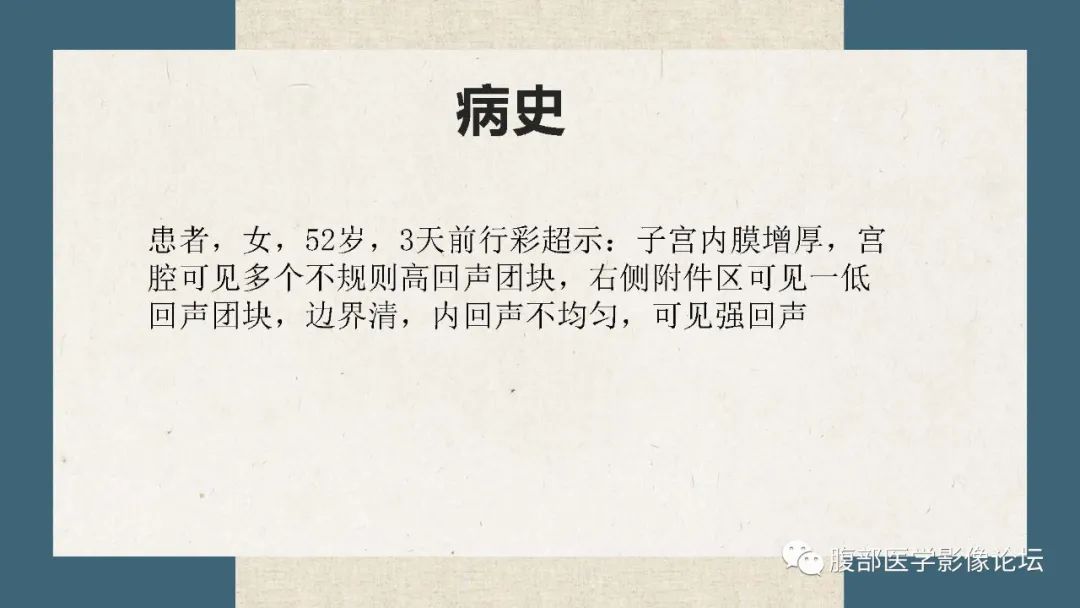 影像PPT - 【病例】卵巢纤维瘤 VS 子宫阔韧带肌瘤-15