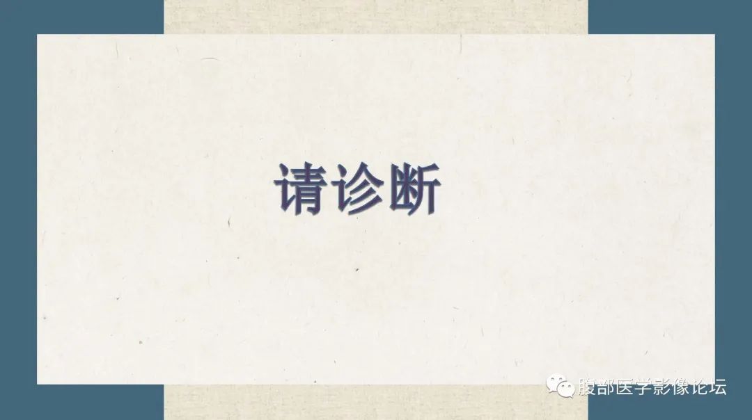 影像PPT - 【病例】卵巢纤维瘤 VS 子宫阔韧带肌瘤-25