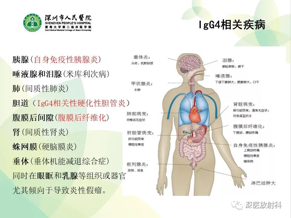 影像PPT - 【PPT】IgG4相关性疾病—腹部脏器受累及影像表现-4