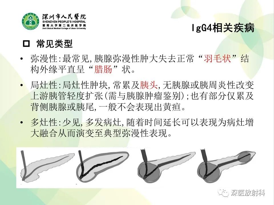 影像PPT - 【PPT】IgG4相关性疾病—腹部脏器受累及影像表现-10