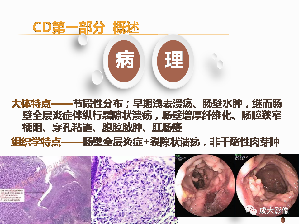 影像PPT - 【PPT】克罗恩病影像学评价-4